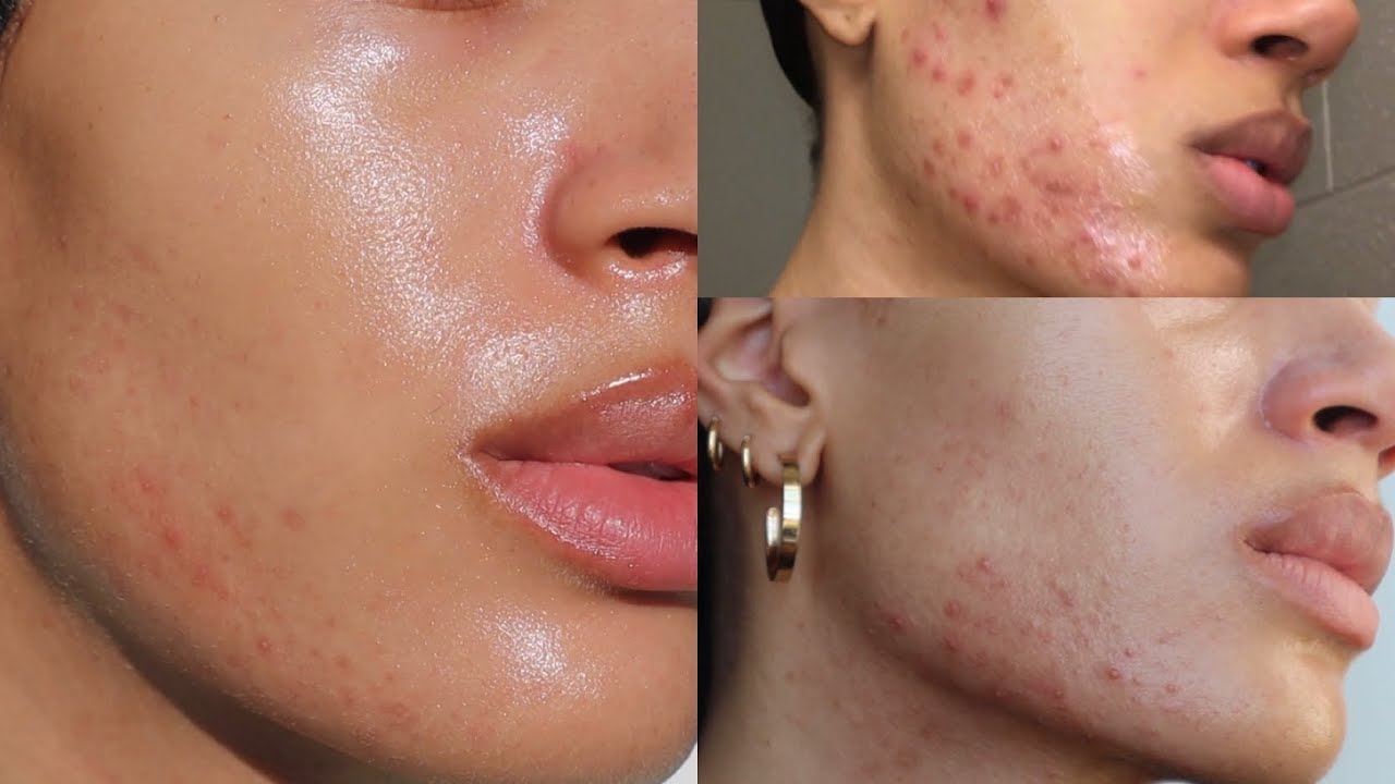 It Girl Skin – Skin Food