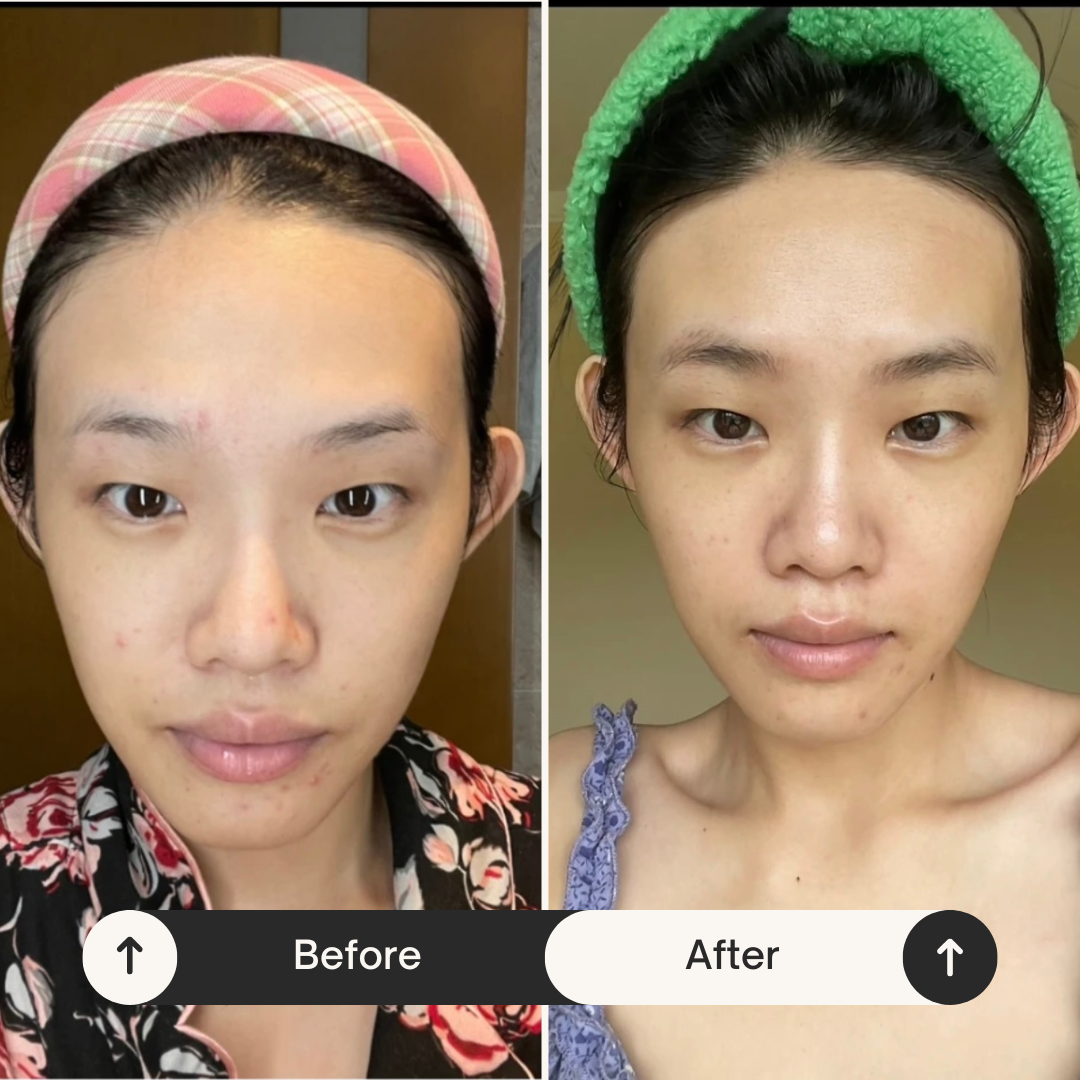 Usma Grass Eyebrow Regrowth Mask